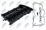 NTY ENGINE VALVE COVER HYUNDAI I20 1.4,1.6 2008-,I30 1.4,1.6 2007-,IX20 1.4,1.6 2010-,KIA CEED 1.4,1.6 2006-,PRO CEED 1.4,1.6 2008-,RIO 1.4,1.6 2011-,SOUL 1.6 2009-,VENGA 1.4,1.6 2010-