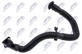 NTY CRANKCASE BREATHER AUDI A3, A4, A6, TT, VW EOS, GOLF V, JETTA III, PASSAT 2.0 04-15